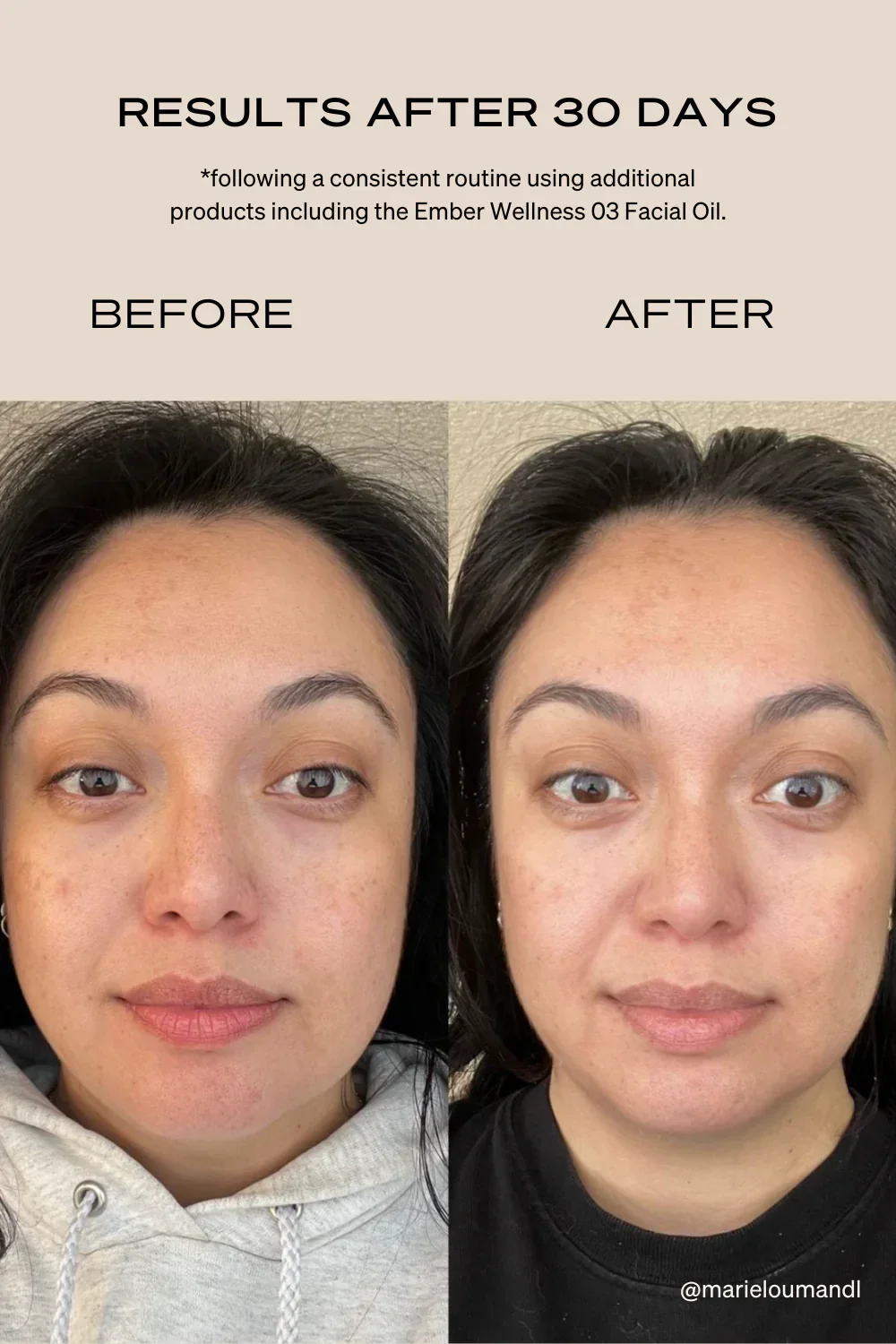 The Rejuvenating Light Therapy Mask - Image 5