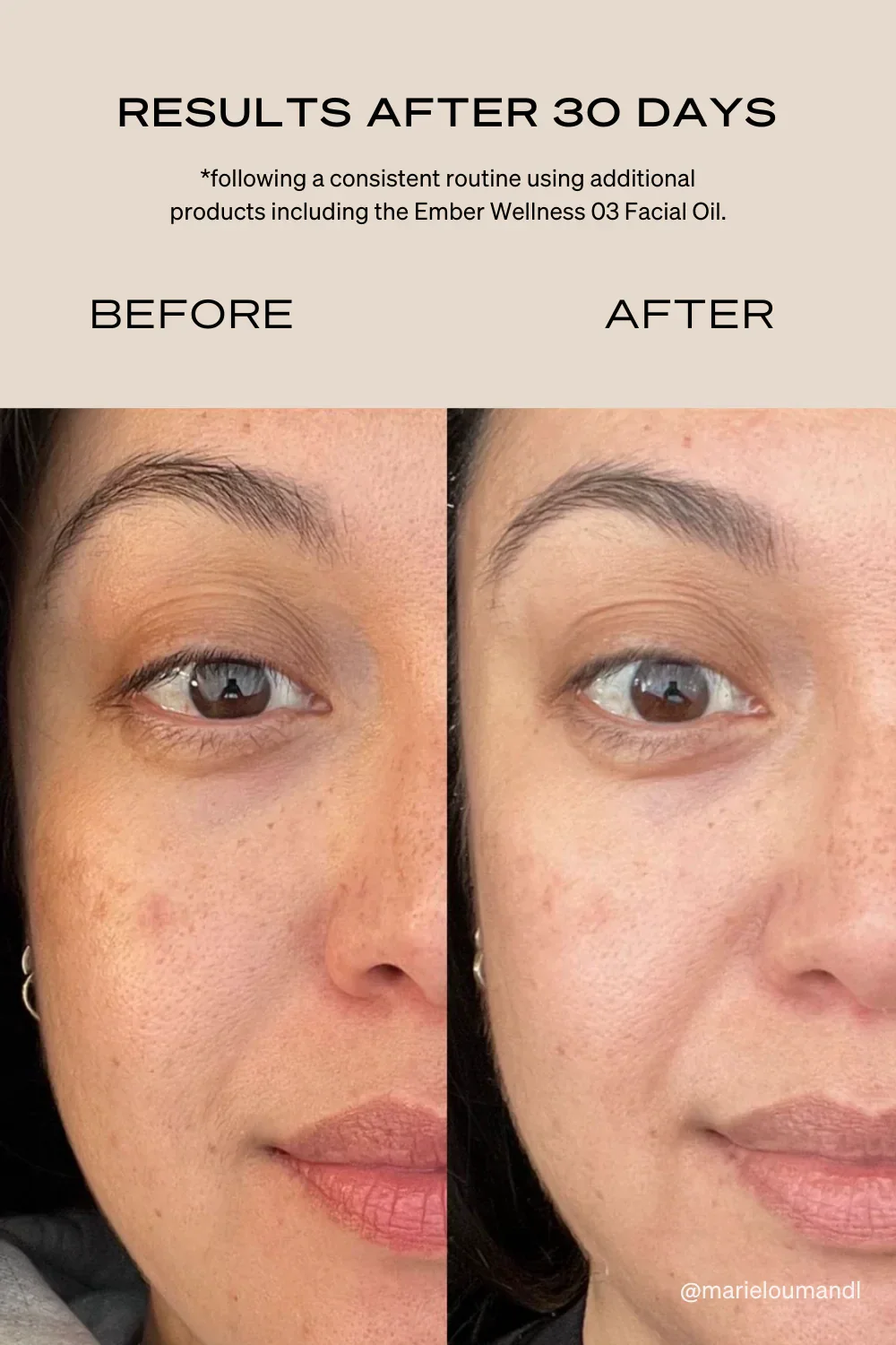 The Rejuvenating Light Therapy Mask - Image 6